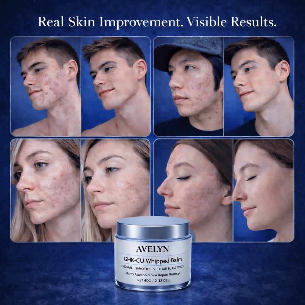 AVELYN GHK-CU Whipped Balm – Advanced Acne & Skin Repair