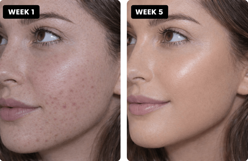 Emma T, 25, Limerick